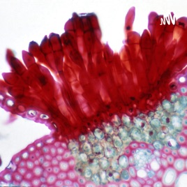 Difference between colonial and filamentous organism