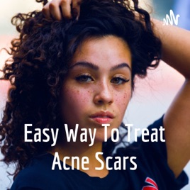 Easy Way To Treat Acne Scars
