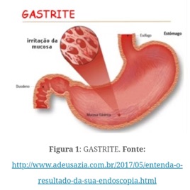Gastrite-Química