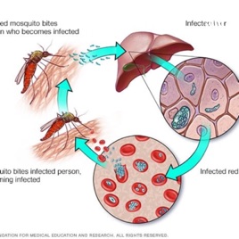 Malaria Cerebral