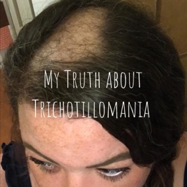 My Truth about Trichotillomania