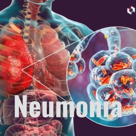 Neumonía
