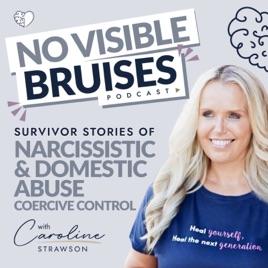 No Visible Bruises