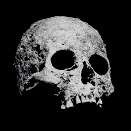 Ossos Perdidos