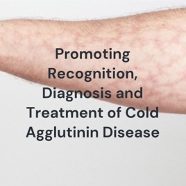 Promoting Recognition, Diagnosis and Treatment of Cold Agglutinin Disease