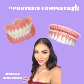 PROTESIS COMPLETA POR ANGELA MARTINEZ