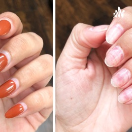 Take Of Your Nails