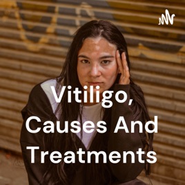 Vitiligo, Causes And Treatments